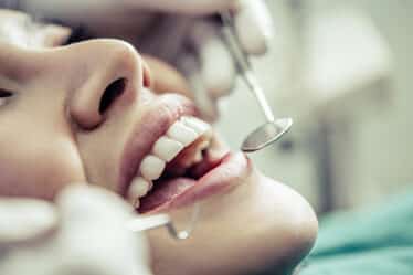 Implantes dentários gratuitos pelo SUS